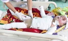 Nỗi đau thể xác tìm niềm hy vọng ở viện Bỏng