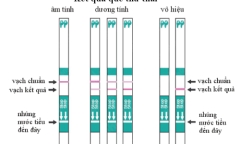 Mách bạn gái cách dùng que thử thai chính xác