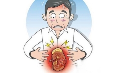 5 dấu hiệu rõ ràng cảnh báo nguy cơ mắc bệnh ung thư thận