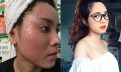Dùng rượu thuốc bắc để 