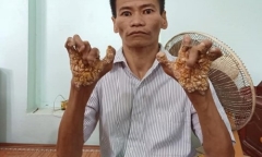 Bệnh