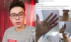 Top 3 Vietnam Idol 2014 Đông Hùng bị chủ nợ chém vì mẹ ruột