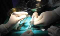 Sau cuộc hôn nhân đổ vỡ, cô gái bẩm sinh khuyết âm đạo đi phẫu thuật tạo hình