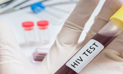 50.000 người có thể nhiễm HIV mà không biết