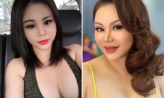 Sở hữu ngoại hình trẻ trung căng đầy sau 20 lần 