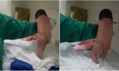 Kì lạ bé sơ sinh vừa chui khỏi bụng mẹ đã 