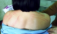 Thông tin mới nhất vụ nữ Luật sư bị đánh gãy răng ngay tại phòng xử án