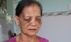 Dậy sóng mạng xã hội: Con dâu túm tóc đánh mẹ chồng tím mặt