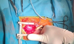 Tin tức đời sống mới nhất ngày 2/7/2019: Phẫu thuật tim hở cho bé sơ sinh nặng chỉ 1,6kg