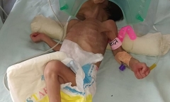 Tin tức đời sống mới nhất ngày 16/10/2019: Bé 3 tuổi sống sót kỳ diệu dù bị chôn sâu gần 1m
