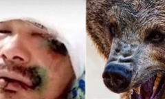 Tin tức đời sống mới nhất ngày 5/7/2019: Kinh hãi cảnh người đàn ông bị gấu hoang ngoạm đầu, cấu xé