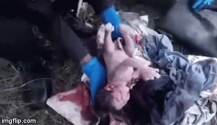 Đi thu gom phế liệu phát hiện bé sơ sinh còn nguyên dây rốn trong túi rác