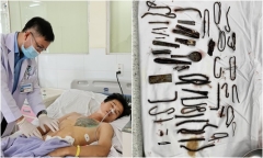Tin tức đời sống ngày 18/1: Nam thanh niên trầm cảm 