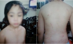 Xôn xao nghi án bố đẻ và mẹ kế đánh gãy xương sườn bé trai ở Hà Nội