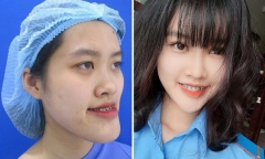Khổ sở vì ngoại hình, nữ sinh cảnh sát chi 300 triệu đồng phẫu thuật thẩm mỹ và cái kết ngọt ngào