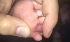 Tin tức đời sống mới nhất ngày 15/7/2019: Con suýt đứt ngón chân vì 1 sợi tóc trên giường ngủ