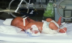 Không muốn con sinh ra bị bại não, mẹ bầu cần tránh ăn những loại cá này