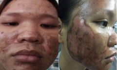 Cô gái xinh đẹp biến thành
