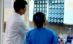 Lần đầu có bệnh nhân xuất huyết não do ngộ độc ma túy đá