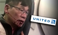 David Dao có thể được đền triệu đô vì ‘bị gãy mũi, mất 2 răng cửa’