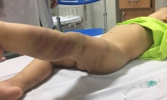 Mẹ cháu bé 14 tháng nghi bị đánh đập thậm tệ là ai?