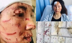 Nghi ngoại tình, chồng hợp lực cùng bố đánh đập vợ dã man trên phố