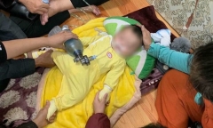 Tin tức đời sống mới nhất ngày 21/11/2018: Chồng tiêm filler làm mù mắt vợ