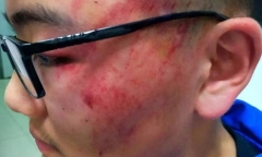 Giáo viên bị sa thải vì tát hằn cả bàn tay trên mặt học sinh 