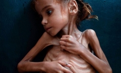 Ám ảnh nạn đói tại Yemen: 85.000 trẻ em tử vong vì thiếu dinh dưỡng