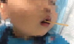 Cậu bé 3 tuổi suýt mất mạng vì vừa ăn xúc xích vừa làm điều mà nhiều đứa trẻ thường thích