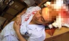 Bố bệnh nhi ném cốc thủy tinh làm Phó khoa chảy máu ròng ròng bị tạm giữ