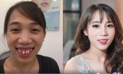 Nữ sinh trường Báo 