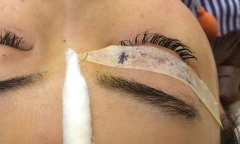 Bi hài hậu vận sau thẩm mỹ: 