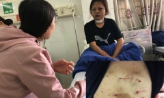Tin tức thời sự 24h mới nhất ngày 17/1/2019: Thiếu nữ 17 tuổi trốn khỏi 