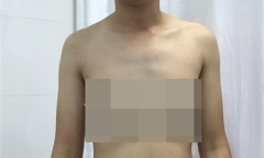 Việt Nam: Chuẩn bị phẫu thuật chuyển giới cho trường hợp đầu tiên