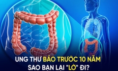 Những triệu chứng báo hiệu ung thư, ai cũng cần biết