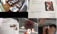 Vụ cô giáo đánh tới tấp vào đầu học sinh lớp 2 ở Hải Phòng: Ban giám hiệu nói gì?