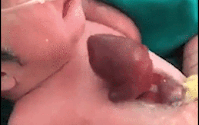 Lặng người khoảnh khắc trái tim ngoài lồng ngực bé sơ sinh đập từng nhịp