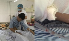 Ăn cua đá nhiễm sán, nam thanh niên suýt gặp tử thần vì tràn dịch màng phổi