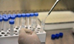 Tình hình dịch virus corona ngày 1/2: 9.952 ca nhiễm bệnh, Nga khuyến nghị 3 loại thuốc điều trị 2019-nCov