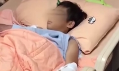 Vỡ bồn rửa tay, bé trai 10 tuổi nhập viện cấp cứu do bị thương nặng
