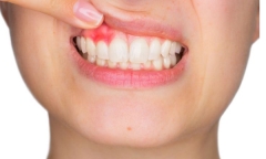5 dấu hiệu cho thấy bạn đang già đi nhanh chóng, cần có phương pháp làm chậm quá trình lão hóa