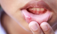 Bé trai 11 tuổi ở TP.HCM mắc bệnh giang mai, nguyên nhân vô cùng bất ngờ