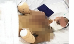 Nghi án nam thanh niên cụt 2 tay do sản xuất pháo: Công an Hải Phòng lên tiếng 