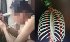 Học mẹo giảm cân trên mạng, cô gái gặp cái kết nhớ đời