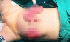 Tin tức đời sống mới nhất ngày 17/7/2018: Mẹ có biểu hiện tâm thần đâm con 11 tháng tuổi
