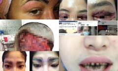 Muốn làm đẹp đón Tết: Chị em sợ biến
