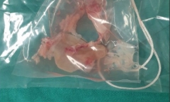Tin tức đời sống mới nhất ngày 26/10/2019: Kinh hoàng cảnh lấy cả ổ sán trong não người