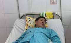 17 khách du lịch nhập viện nghi ngộ độc thực phẩm ở Đà Nẵng