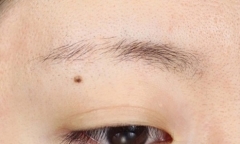 Nguy cơ mắc ung thư vòng họng từ thói quen 38,9% đàn ông Việt mắc phải